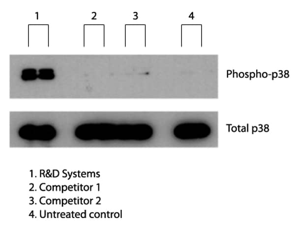 Recombinant Human Irisin Induces p38 MAPK Phosphorylation in 3T3-L1 Preadipocytes.