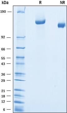 Recombinant Rat Jagged 1 His Tagged Protein SDS-PAGE