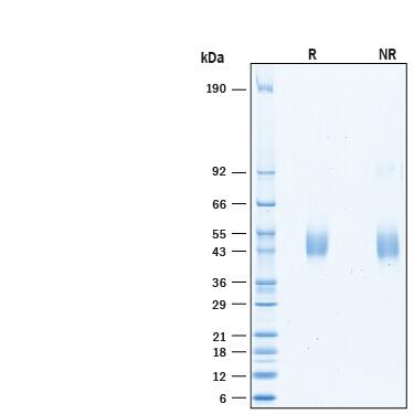 Recombinant Human KIR3DL3/CD158z His-tag Protein SDS-PAGE