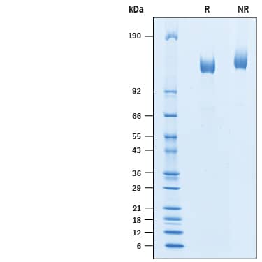 Recombinant Human Klotho His-tag Protein SDS-PAGE