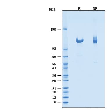 Recombinant Human Klotho beta Protein SDS-PAGE