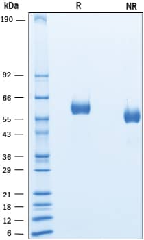Recombinant Human LAG-3 His-tag Protein SDS-PAGE