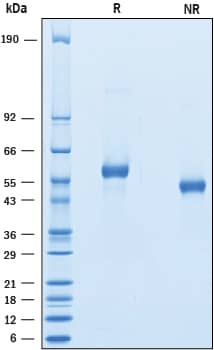 Recombinant Cynomolgus LAG-3 His-tag Protein SDS-PAGE