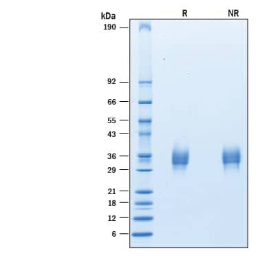 Recombinant Human LAIR1 His-tag Avi-tag Protein SDS-PAGE