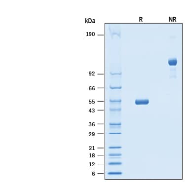 Recombinant Human LAIR2 Fc Chimera Protein SDS-PAGE