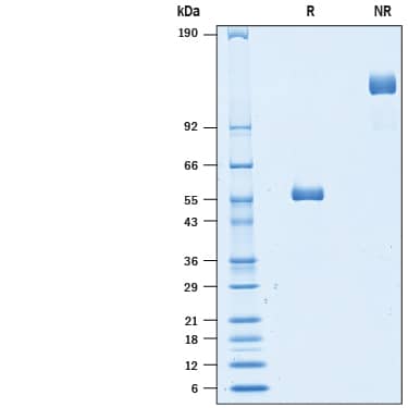 Recombinant Cynomolgus Monkey LAIR2 Fc Chimera Protein SDS-PAGE
