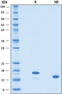 Recombinant Human LECT2 Protein SDS-PAGE