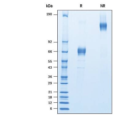 Recombinant Human LRRC52 Fc Chimera Protein SDS-PAGE