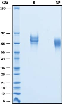 Recombinant Mouse L-Selectin/CD62L His-tag Protein SDS-PAGE