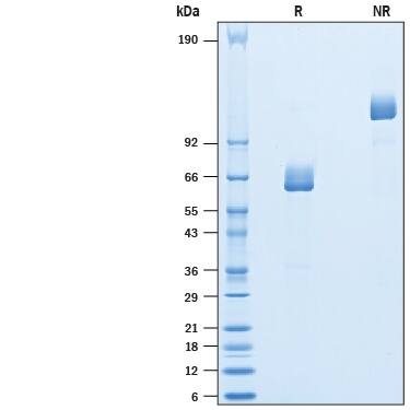 Recombinant Human Langerin/CD207 Fc Chimera Protein SDS-PAGE