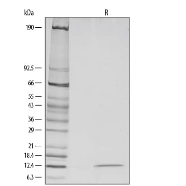 Recombinant Human Leptin Protein SDS-PAGE