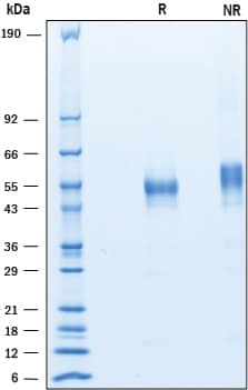 Recombinant Mouse Lymphotoxin alpha1/beta2 Protein SDS-PAGE