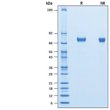 Recombinant Human Lymphotoxin alpha1/beta2 Avi Protein SDS-PAGE