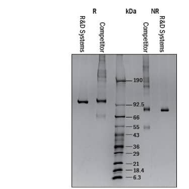 Recombinant Human Lysyl Oxidase Homolog 2 Protein SDS-PAGE