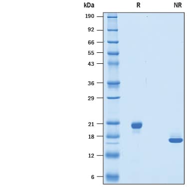 Recombinant Rat MANF His-tag Protein SDS-PAGE