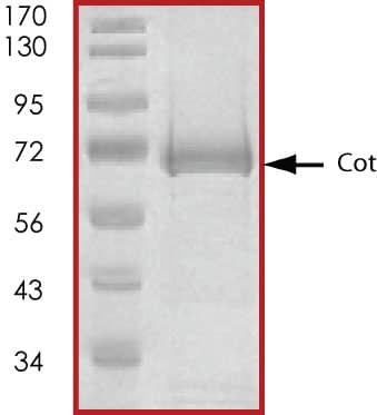 Recombinant Human Active MAP3K8/Tpl2/COT Protein SDS-PAGE.