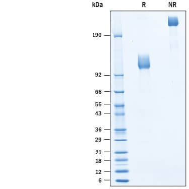 Recombinant Human M-CSF R/CD115 Fc Avi-tag Protein SDS-PAGE
