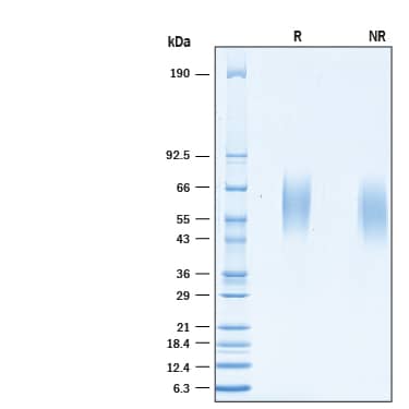 Recombinant Human MICA His-tag Protein SDS-PAGE
