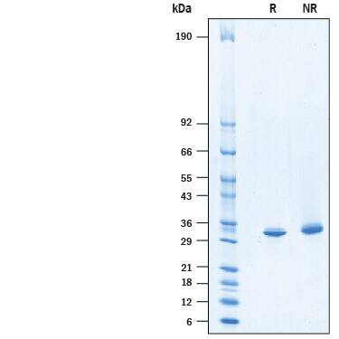 Recombinant Human MTAP His-tag Protein SDS-PAGE