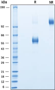 Recombinant Human NKG2C/CD159c Fc Chimera Protein SDS-PAGE