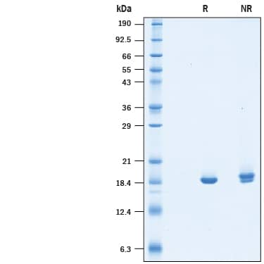 Recombinant Human NM23-H2 His-tag Protein SDS-PAGE