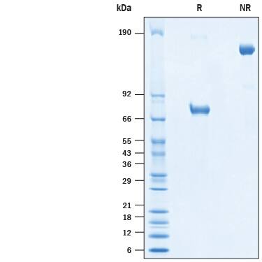 Recombinant Cynomolgus Monkey Nectin-2/CD112 Fc Protein SDS-PAGE