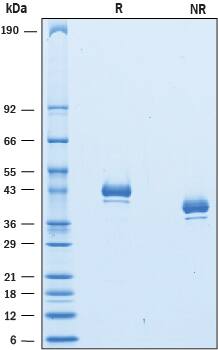 Recombinant Cynomolgus/Rhesus Macaque Nectin-4 Protein SDS-PAGE