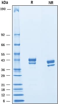 Recombinant Rat Nectin-4 His-tag Protein SDS-PAGE