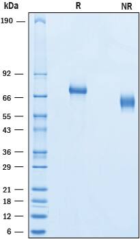 Recombinant Human Netrin-G1a His-tag Protein SDS-PAGE