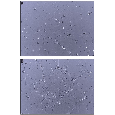 Recombinant Human Neuroligin 4Y/NLGN4Y Protein Bioactivity