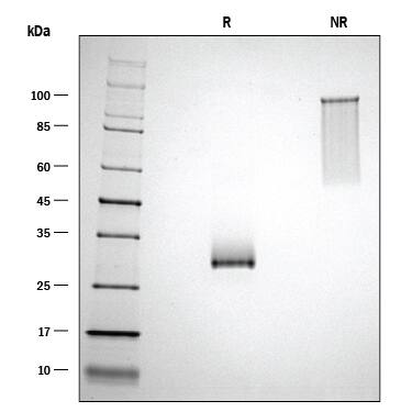 ProDots Recombinant Human Noggin Protein SDS-PAGE