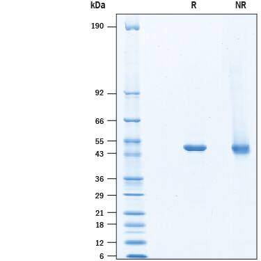 Recombinant Human ODC1 His-tag Protein SDS-PAGE