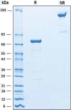 Recombinant Mouse OLT-2/TARM1 Fc Chimera Protein SDS-PAGE