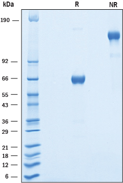 Recombinant Human OSCAR Fc Chimera Protein SDS-PAGE