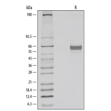 Recombinant Human Osteopontin (OPN) Protein SDS-PAGE