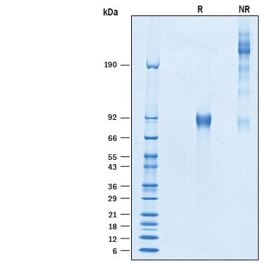 Recombinant Human Otolin-1 His-tag Protein SDS-PAGE