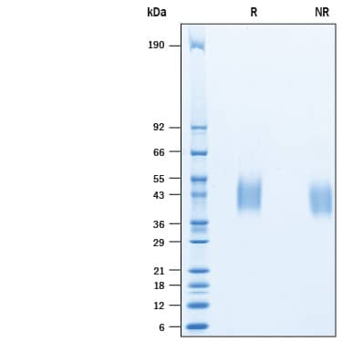 Recombinant Porcine PD-1 His-tag Protein SDS-PAGE