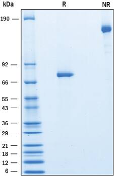 Recombinant Human PDGFRL Fc Chimera Protein SDS-PAGE