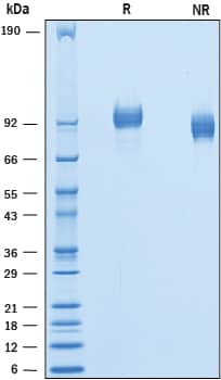 Recombinant Mouse PDGF R beta His-tag Protein SDS-PAGE