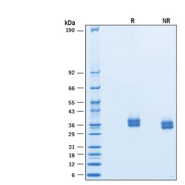 Recombinant Cynomolgus Monkey PD-L1/B7-H1 His Protein SDS-PAGE