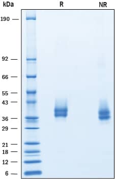 Recombinant Human PD-L1/B7-H1 His-tag Avi-tag Protein SDS-PAGE