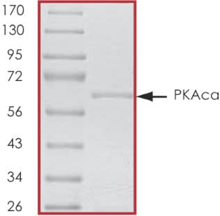 Recombinant Human Active PKA C alpha Protein SDS-PAGE