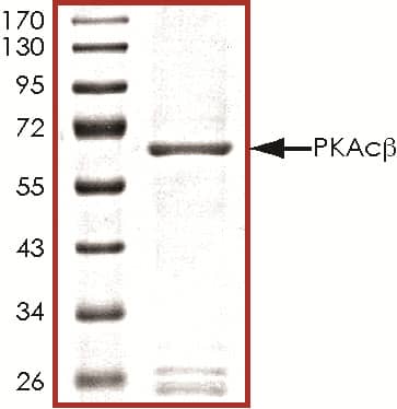 Recombinant Human Active PKA C beta Protein SDS-PAGE