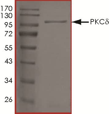 Recombinant Human Active PKC delta Protein SDS-PAGE