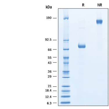 Recombinant Human PON1 His-tag Fc Chimera Protein SDS-PAGE