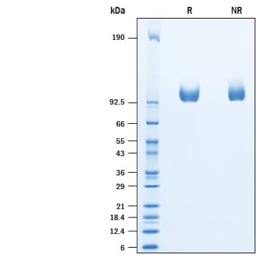 Recombinant Human PSMA/FOLH1/NAALADase I His Avi Protein SDS-PAGE