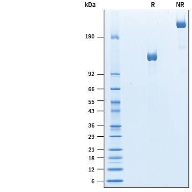 Recombinant Mouse PTK7/CCK4 Fc Chimera Protein SDS-PAGE