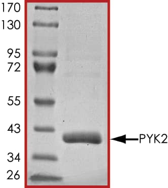 Recombinant Human Active PYK2/FAK2 Protein SDS-PAGE