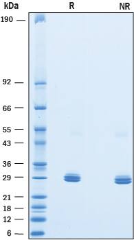 Recombinant Human Pentraxin 2/SAP His-tag Protein SDS-PAGE