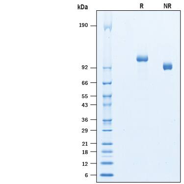 Recombinant Human RECK His-tag Protein SDS-PAGE